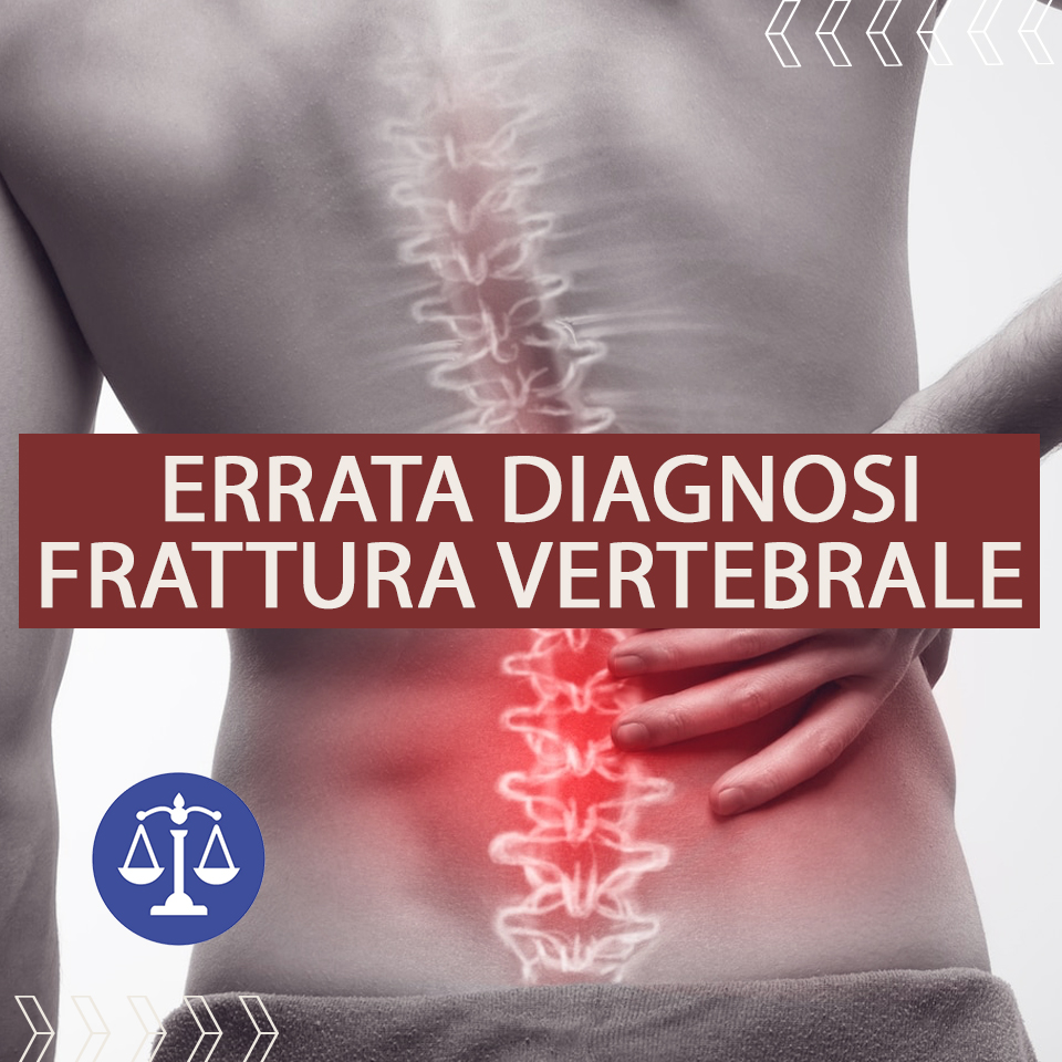 Errata diagnosi Frattura vertebrale