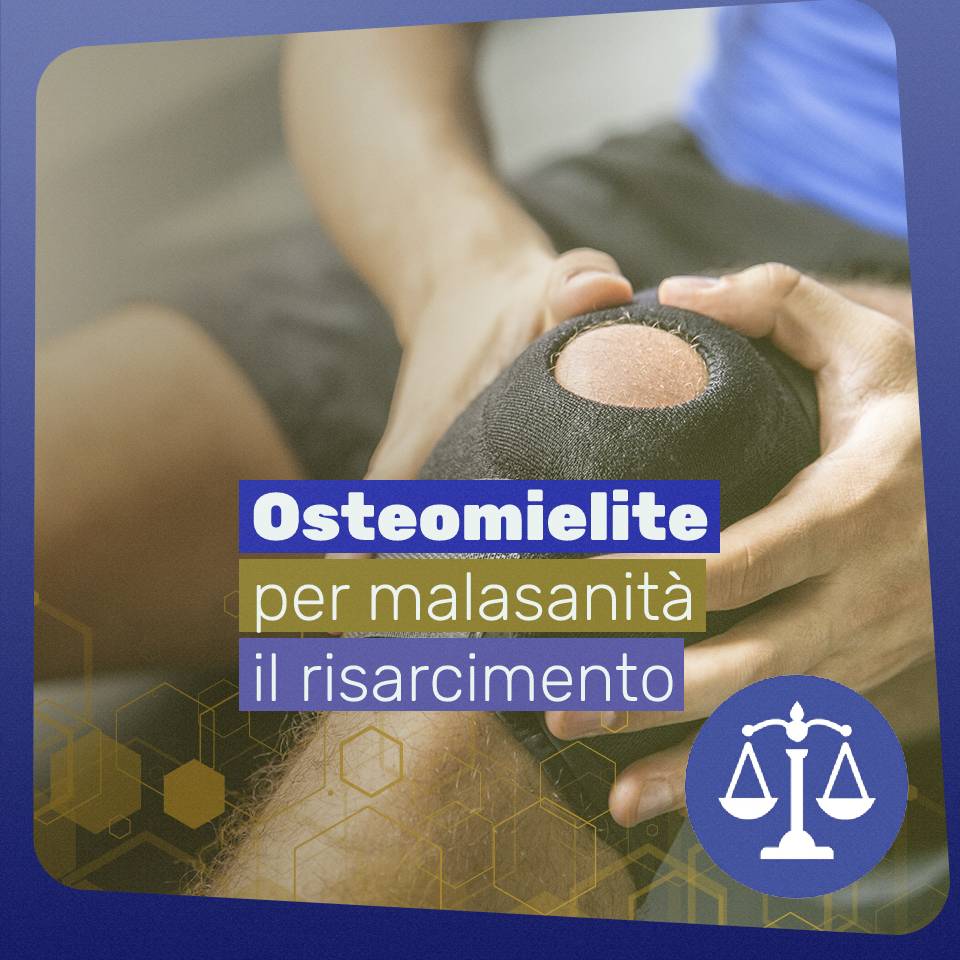 Osteomielite per malasanità: il risarcimento